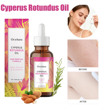 🌿 CYPERUS ROTUNDUS OIL